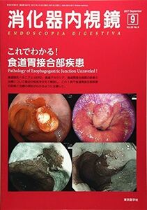 [A01710809]消化器内視鏡 Vol.29 No.9(201 これでわかる!食道胃接合部疾患 [単行本] 消化器内視鏡編集委員会