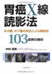 [A01254680]胃癌X線読影法─ネガ像，ポジ像の対比による難読影103症例の解析─ [単行本（ソフトカバー）] 中村 信美