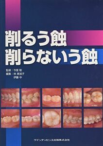 [A01468381]削るう蝕 削らないう蝕 [単行本（ソフトカバー）] 今里 聡、 林 美加子; 伊藤 中