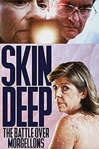 Skin Deep: The Battle Over Morgellons [DVD]　(shin