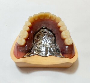 送料込み　上顎金属床　歯科 サンプル 見本 入れ歯 総義歯　フルデンチャー 歯科技工　自費　資料