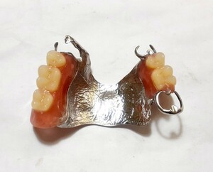 送料込み　歯科 部分床義歯 金属床 パーシャルデンチャー サンプル 模型 見本 入れ歯 補綴 フルデンチャー 説明 技工 資料 自費