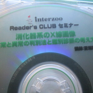 ●送料込/未使用 (株)インターズー DVD Reader's CLUB セミナー 消化器系のX線画像 (1022FI(2))8B〒-1の画像2