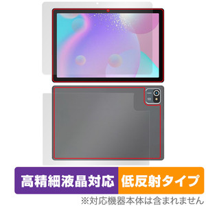 HiGrace MB1001 表面 背面 フィルム OverLay Plus Lite タブレット用保護フィルム 表面・背面セット 高精細液晶対応 アンチグレア 低反射