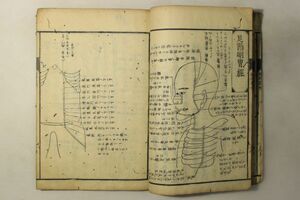 「経絡発明」菊地玄蔵 萬屋太次右衛門 宝暦3年 1冊｜鍼灸 医学書 医書 絵図 絵入り 木版画 東洋医学 漢籍 漢文 中国 古書 和本 古典籍 m27