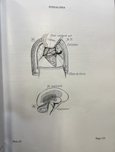 『An Atlas of Neurosurgical Techniques Tapa dura Importacin, 1 Enero 1960 医学書 洋書』 _画像8