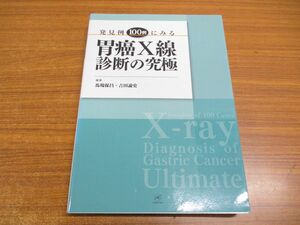 ▲01)発見例100例にみる胃癌X線診断の究極/馬場保昌/吉田諭史/株式会社ベクトル・コア/2016年発行