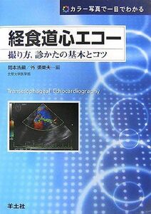 [A01297048]経食道心エコー―撮り方、診かたの基本とコツ カラー写真で一目でわかる 浩嗣，岡本; 須美夫，外