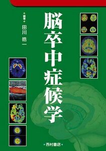 [A01295411]脳卒中症候学 [大型本] 田川 皓一