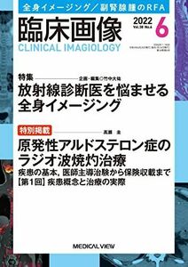 [A12232166]臨床画像 2022年6月号 特集:特集:放射線診断医を悩ませる全身イメージング/特別掲載:原発性アルドステロン症のラジオ波焼灼治