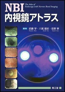 [A01046402]NBI内視鏡アトラス 武藤 学