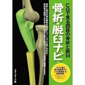 【中古】ラウンドフラット 骨折・脱臼ナビ スタンダード版(一般、学生向)