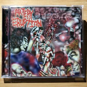 ARTERY ERUPTION - Gouging Out Eyes Of Mutilated Infants【CD】ブルデス デスメタル グラインド death grind gore