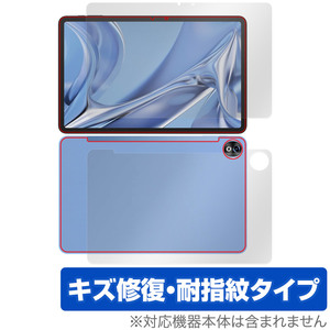 DOOGEE T20 Ultra 表面 背面 フィルム OverLay Magic ドゥージー タブレット用保護フィルム 表面・背面セット 傷修復 耐指紋 指紋防止