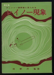 レイノー現象 チェーンソー使用者に見られる 林野庁監　昭和44年 　　検:手指蒼白発作チアノーゼ 振動障害 振動工具病 予防対策 伐木 林業