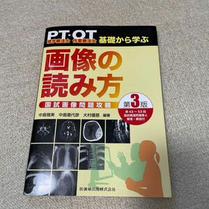 ＰＴ・ＯＴ基礎から学ぶ画像の読み方　国試画像問題攻略 （第３版） 中島雅美／編著　中島喜代彦／編著　大村優慈／編著