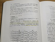 Φ01□臨床脳波学 第2版 鳥取大学教授 大熊輝雄(著) 1974年 医学書院発行 231227_画像6