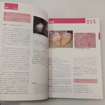 zaa-536♪目でみるトレーニング-認定内科医・認定内科専門医受験のための 2012/6/1 「medicina」編集委員会 (監)岡崎仁昭 (編)_画像5