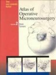 [A12192545]Atlas of Operative Microneurosurgery: Brain Tumors， Volume 2 Tew