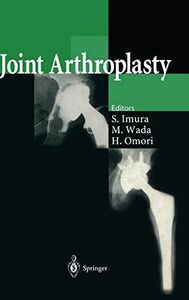 [A01973328]Joint Arthroplasty [ハードカバー] Imura， Shinichi、 Wada， Makoto; Omori
