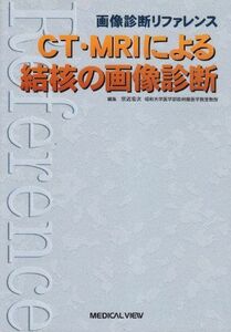 [A01371340]CT・MRIによる結核の画像診断―画像診断リファレンス 宏次，宗近