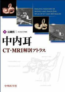 [A12223661]中内耳CT・MRI解剖アトラス 長縄 慎二