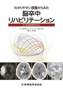 [A01243096]わかりやすい画像からみた脳卒中リハビリテーション [単行本] 宮上 光祐