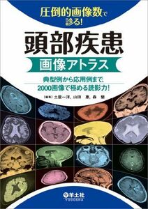 [A01632574]圧倒的画像数で診る! 頭部疾患画像アトラス?典型例から応用例まで、2000画像で極める読影力! [単行本] 土屋 一洋、 山田