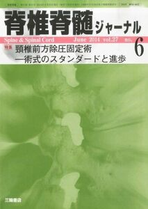 [A01964044]脊椎脊髄ジャーナル 2014年 06月号 [雑誌] [雑誌]