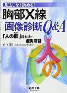 [A01622284]見逃しなく読める!胸部X線画像診断Q&A―「人の肺」読影法と症例演習 山口 哲生