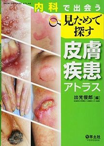 [A01619729]内科で出会う 見ためで探す皮膚疾患アトラス [単行本] 出光 俊郎