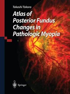 [A01963346]Atlas of Posterior Fundus Changes in Pathologic Myopia [ жесткий чехол ]