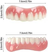 男性と女性の入れ歯、不完全な歯を覆い、自信のほほえみを修復する（2本）_画像2