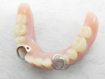 02 00-584206-96 [Y] 歯 歯科金属 義歯 入れ歯 オーラルケア 重さ:約42g 旭00_画像4