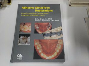 2K1022◆Adhesive Metal-Free Restorations Current Concepts for the Esthetic Treatment of Posterior Teeth Didier Dietschi ▽