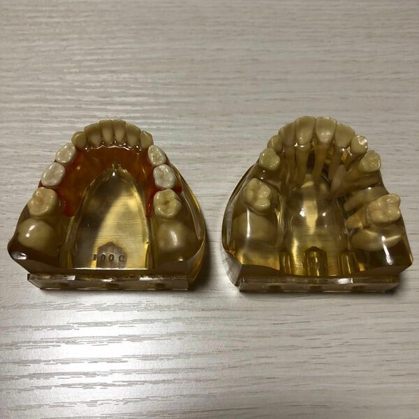 歯科 模型 乳歯