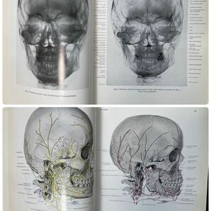 【ペルンコップ アトラス】PERNKOPF★英語版★Atlas of Topographical and Applied Human Anatomy★医学書★臨床応用局所解剖図譜の画像6