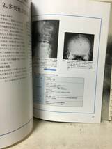 即決　X線フィルムから診断する骨粗鬆症　林 二史_画像4