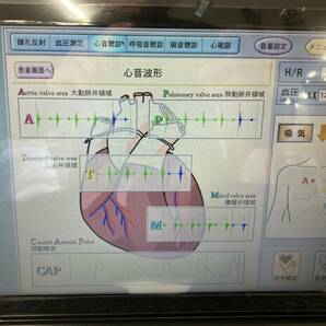 京都科学 フィジカルアセスメントモデル Physiko 臨床看護 教育 実習 医療 介護 看護 授業用 人体模型 モデル 引取限定【H24010404】の画像3