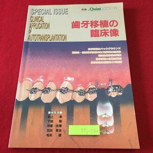 S7j-064 歯牙移植の臨床像 別冊 ザ・クインテッセンス 1996年4月10日 発行 雑誌 歯科 医学 治療 図解 解説 歯牙移植 写真 術式 応用 適応