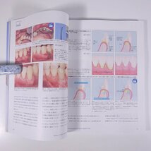 The Quintessence ザ・クインテッセンス 2023/10 雑誌 歯科学 歯医者 歯科衛生士 歯科技工士 デンタル 特集・歯間乳頭再建への可能性_画像7