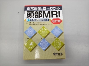 正常画像と並べてわかる頭部MRI ここが読影のポイント 改訂 土屋一洋