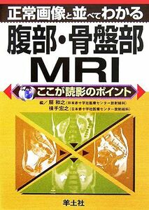 正常画像と並べてわかる腹部・骨盤部ＭＲＩ ここが読影のポイント／扇和之，横手宏之【編】