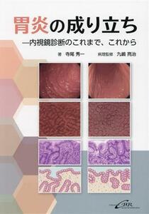 胃炎の成り立ち　内視鏡診断のこれまで、これから／寺尾秀一(著者),九嶋亮治