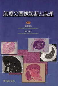 肺癌の画像診断と病理／櫛橋民夫，野口雅之【編著】