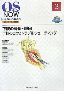 [A11335571]下肢の骨折・脱臼?手技のコツ&トラブルシューティング [DVD付] (OS Now Instruction) 和則， 安田