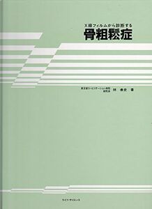 [A11787703]X線フィルムから診断する骨粗鬆症 林 〓史