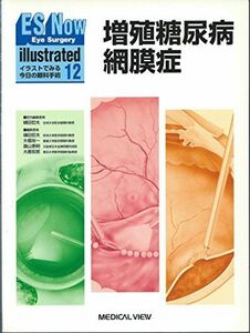 [A11616470]増殖糖尿病網膜症 (Eye Surgery Now illustrated) 哲夫， 樋田