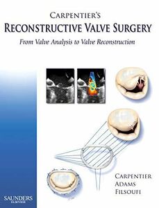 [A12210156]Carpentier's Reconstructive Valve Surgery 1e