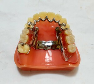 送料込み　上顎金属床+ノンクラスプ　歯科 サンプル 見本 入れ歯 歯科技工　自費　資料